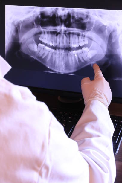Best Emergency Dental Care for Sports Injuries in Corning, IA